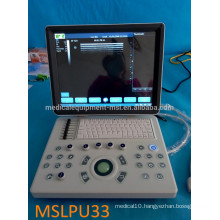 Factory price! MSLPU33-i Portable ultrasound machine/laptop B/W ultrasound machine price